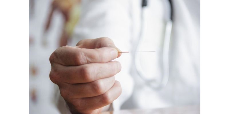 Acupuncture vs Dry Needling